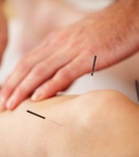 Acupuncture